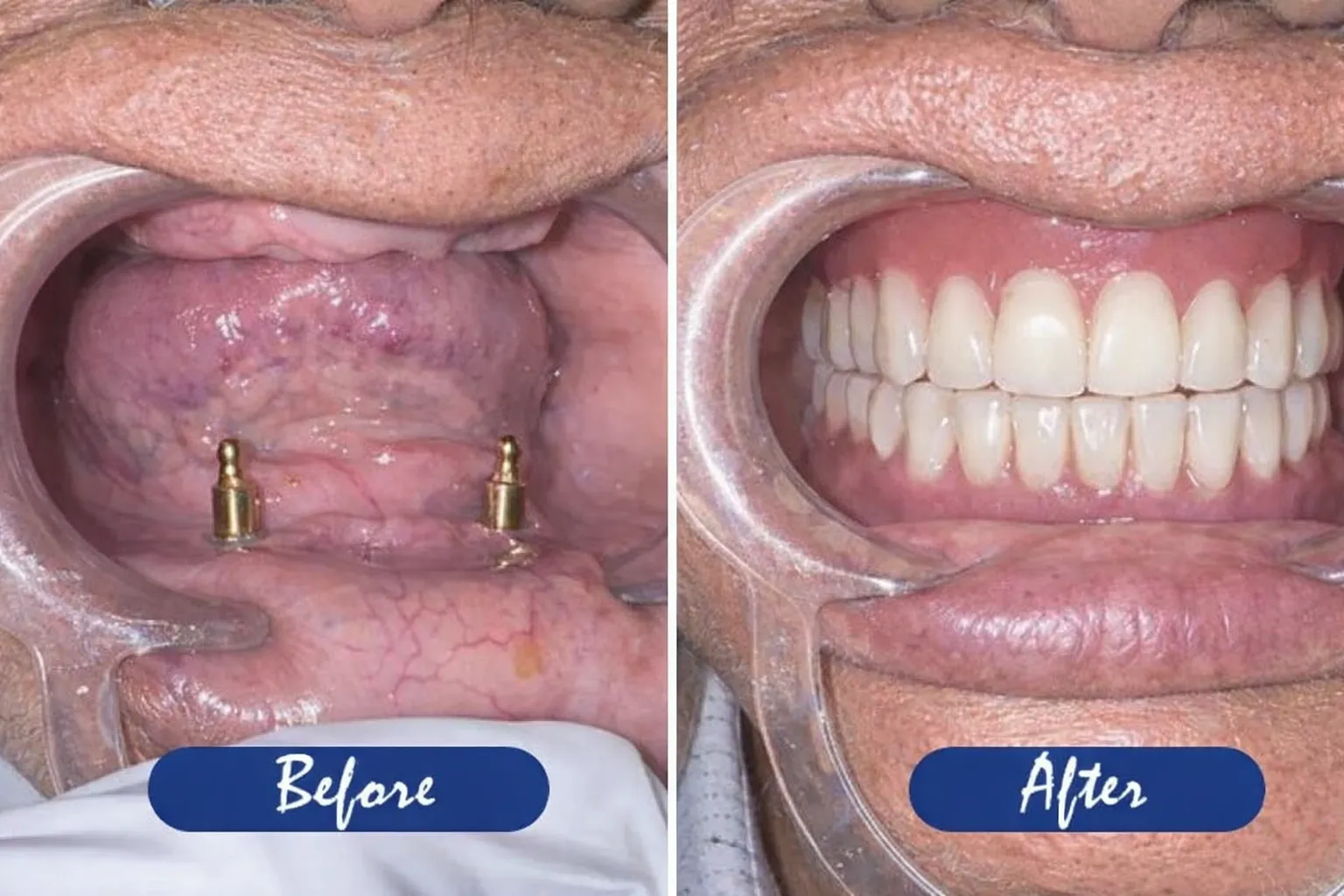 7514a9ff-e198-48b4-9305-daad9b5f4296-converted-from-png