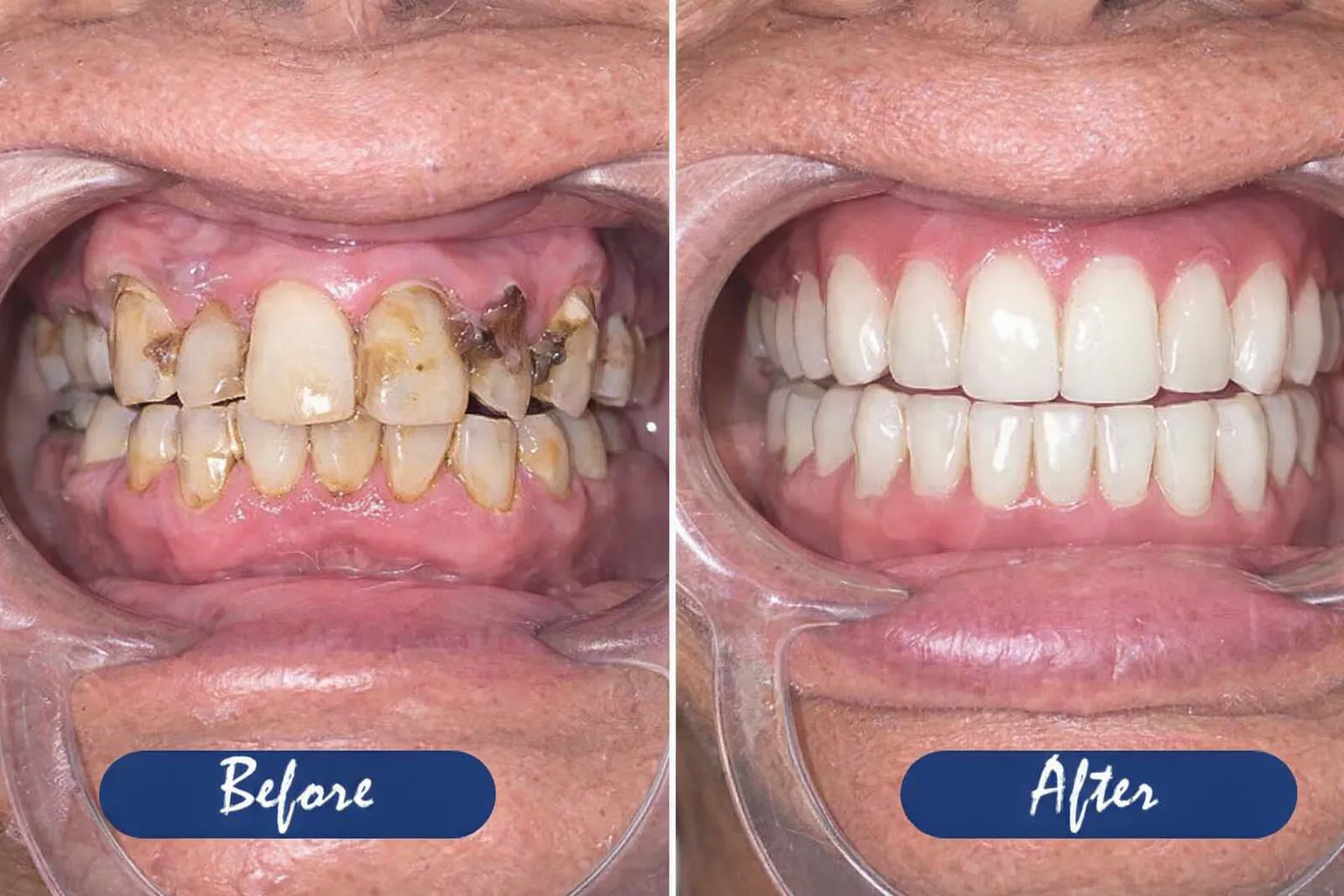 80eca0c4-8b92-4989-b253-db2cb77ee02b-converted-from-png