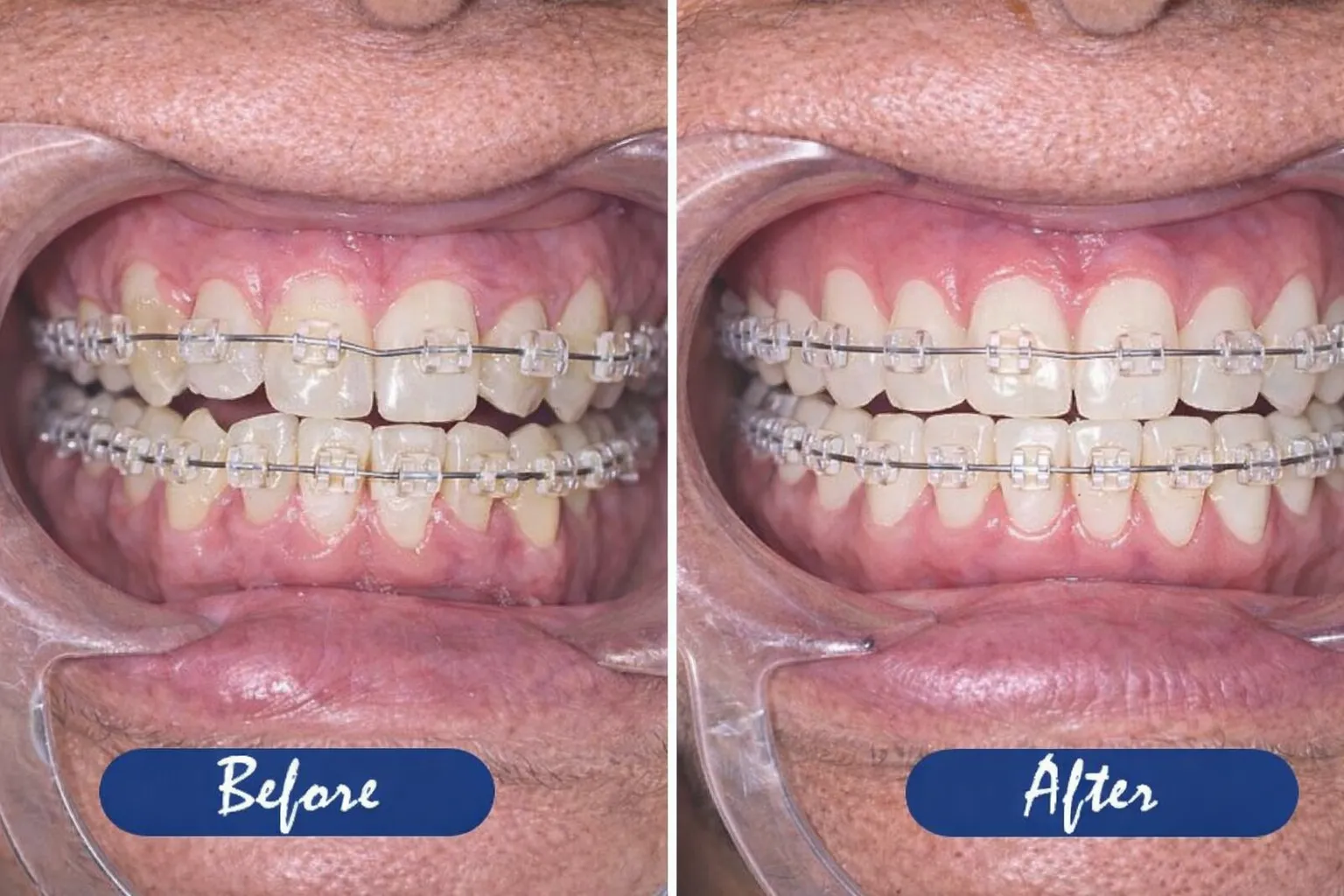 fdba20e2-dc5b-4e22-9c40-d328c7640f42-converted-from-png