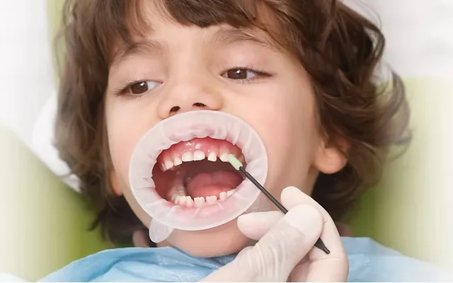 kids_milk_teeth-converted-from-png